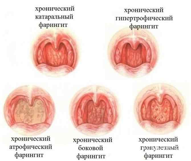 1ec1de257293ef537eb6c0d55c679429