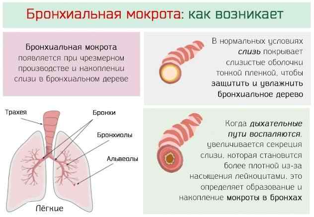 belaya-mokrota-pri-kashle-u-vzroslyh-rebenka-beremennyh-s-temperaturoj2