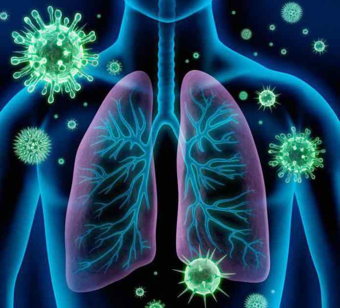 bronchitis