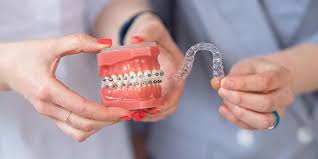 chipped_tooth_front