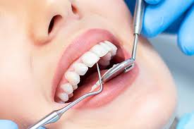 nasmork-u-devushki18