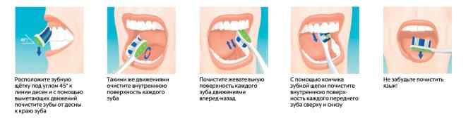nikotinovyj-nalet-na-zubah-kak-izbavitsya4