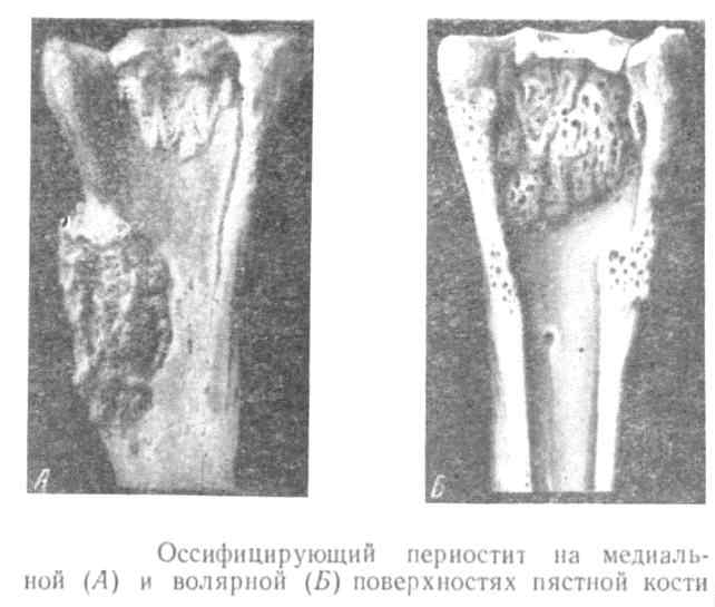 ossifitsiruyushhij-periostit