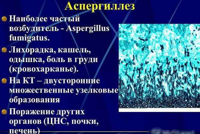 slide-5